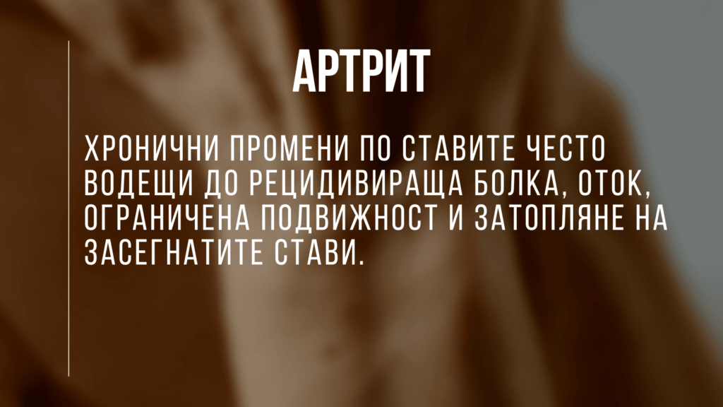 Артрит - №1 статия за видовете, симптоми и лечение 13 артрит, ревматоиден артрит лечение в българия, артрит на рамото лечение, артрит на ръцете лечение, артрит лечение с народна медицина, лечение на ревматоиден артрит форум, лечение артрит протокол, лечение артрит без лекарства, лечение артрит форум, Лечение на ревматоиден артрит, ревматоиден артрит, артрит, лечение, болести, остеоартрит, инфекциозен артрит, артрит по ставите, артрит по коленете, артрит в таза, тазобедрени стави и артрит, артрит по тазобедрените стави, инфекции, микроби, патогени, бактерии, септичен артрит, болка в ставите, ограничение в движение, сковани стави, ставна скованост, здраве, здравни новини, болести, лечение, профилактика, превенция, секс и здраве, сексуална медицина, пикочополови инфекции, рехабилитация