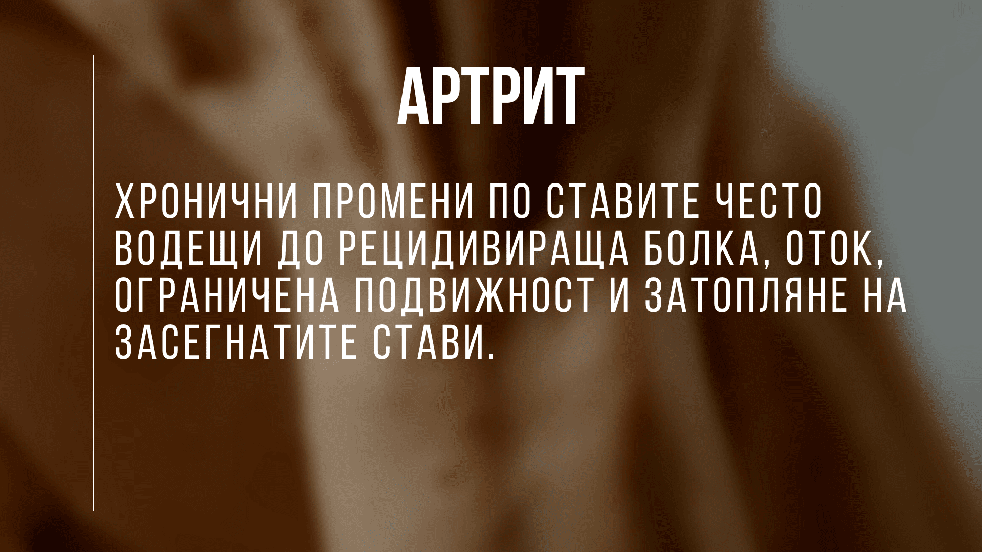 артрит, ревматоиден артрит лечение в българия, артрит на рамото лечение, артрит на ръцете лечение, артрит лечение с народна медицина, лечение на ревматоиден артрит форум, лечение артрит протокол, лечение артрит без лекарства, лечение артрит форум, Лечение на ревматоиден артрит, ревматоиден артрит, артрит, лечение, болести, остеоартрит, инфекциозен артрит, артрит по ставите, артрит по коленете, артрит в таза, тазобедрени стави и артрит, артрит по тазобедрените стави, инфекции, микроби, патогени, бактерии, септичен артрит, болка в ставите, ограничение в движение, сковани стави, ставна скованост, здраве, здравни новини, болести, лечение, профилактика, превенция, секс и здраве, сексуална медицина, пикочополови инфекции, рехабилитация