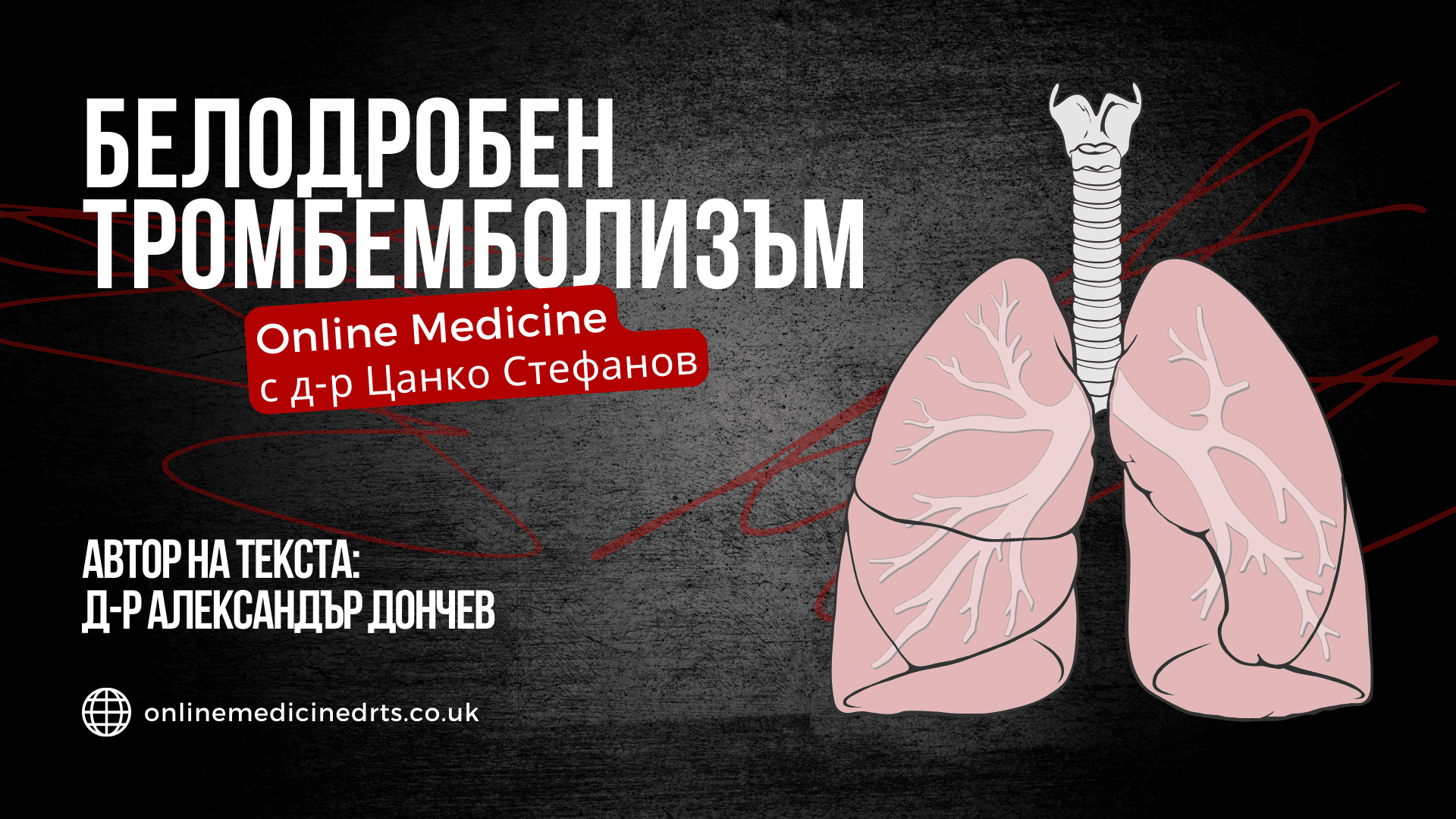 белодробна емболия, белодробен тромбемболизъм, бте, вте, дълбока венозна тромбоза, тромб, ембол, емболия, антикоагуланти, респираторен дистрес синдром, гръдна болка, сърдечна недостатъчност, инфаркт, белодробен инфаркт, инсулт, мозъчен инсулт, кръвоизлив, тромбемболична болест