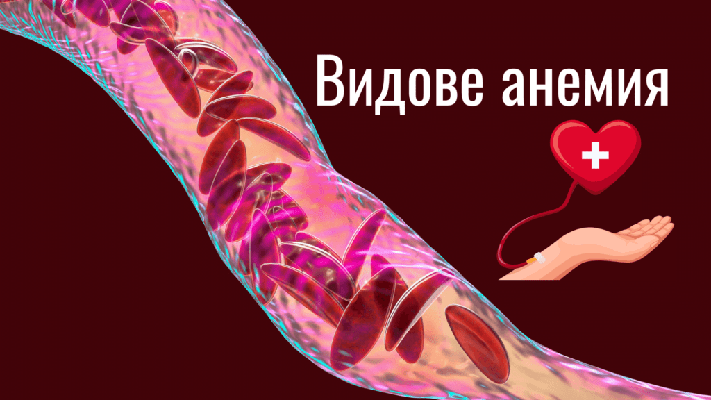 Анемия - видове, основен симптом е умората #1 1 Анемия, видове анемия, желязодефицитна анемия, пернициозна анемия, хемоглобин, хемоглобин S, здраве, умора, летаргия