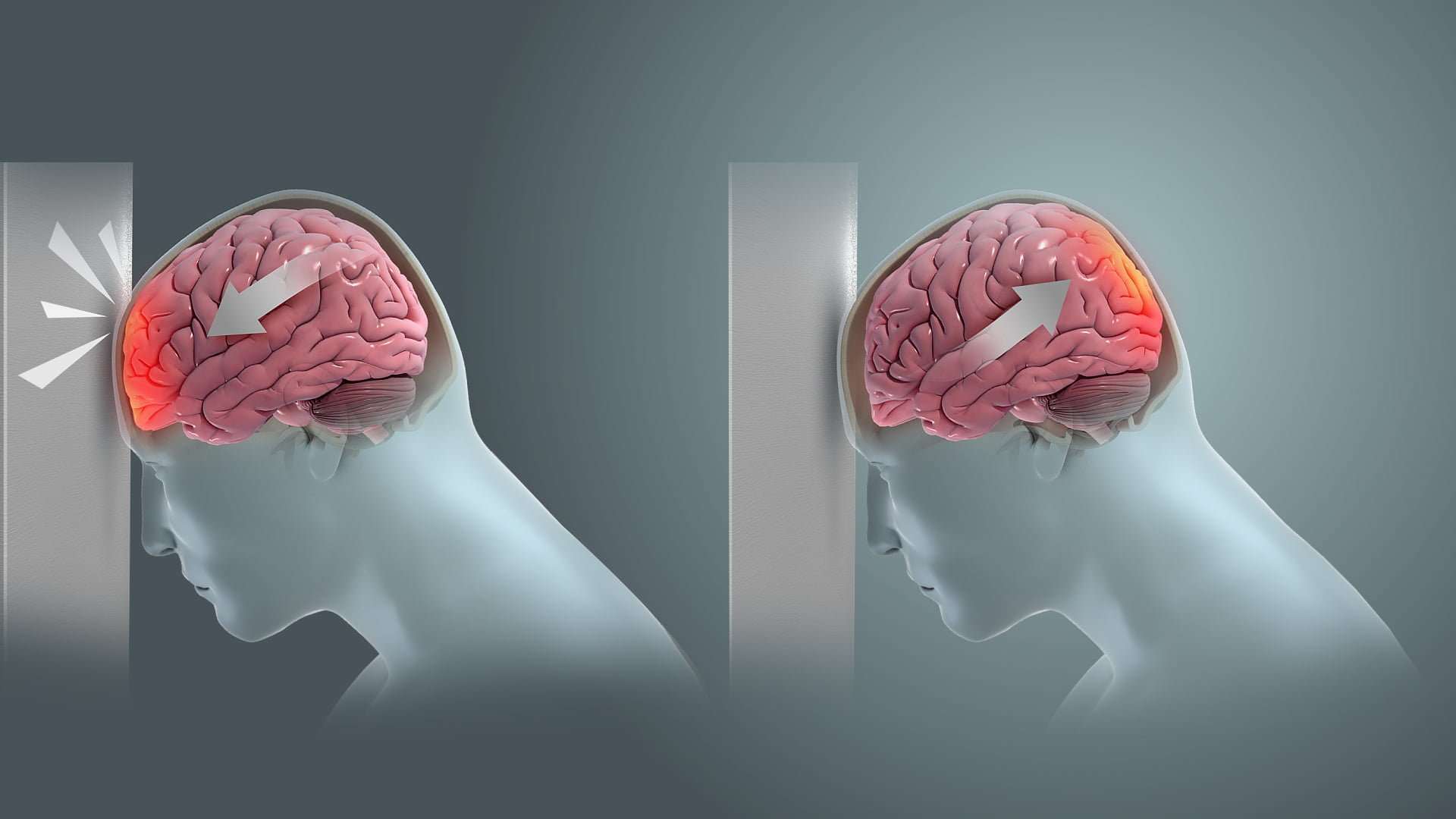 EMDR: 8-фазов метод на десенсибилизация и движение на очите за преодоляване на травми 4 травма на глава