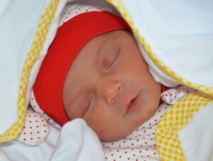 Жълтеница при новородени: диагностика и лечение 5 жълтеница при новородени, пожълтяване на кожата