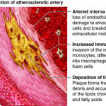Висок холестерол при деца 3 висок холестерол при деца, кръвни клетки