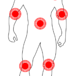 хронична болка, злоупотреба с алкохол