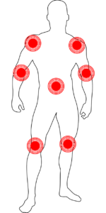 Фибромиалгия - 3 метода за спиране на болката 3 хронична болка злоупотреба с алкохол