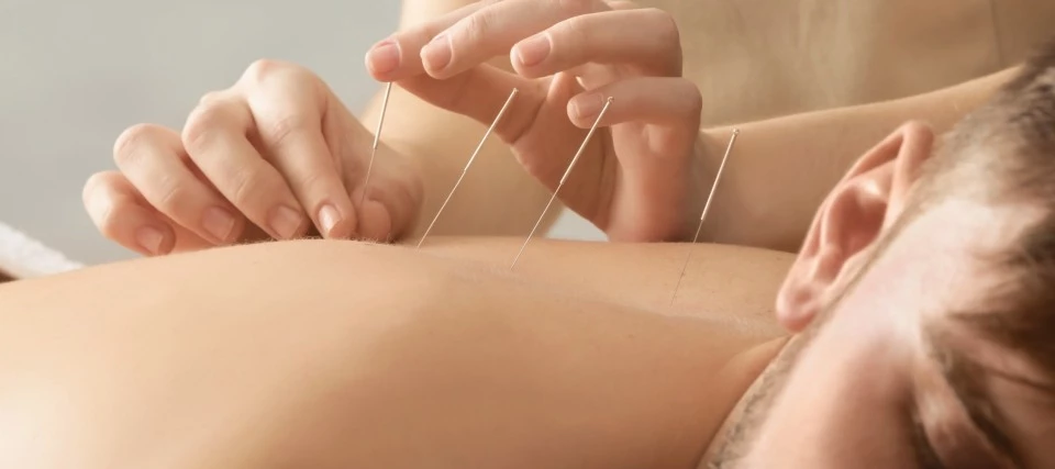 Акупунктура при хронична болка 3 акупунктура