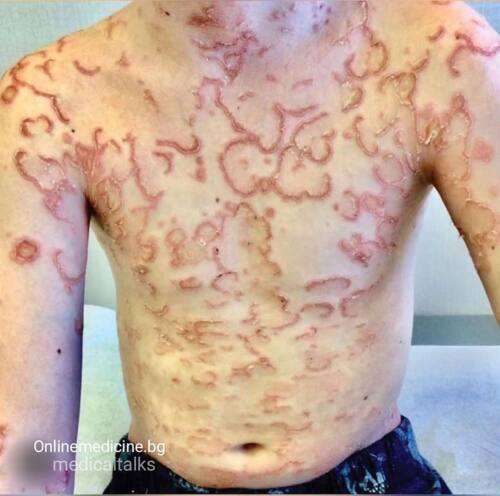 Дерматологичен проблем при 9-годишно момче с находка