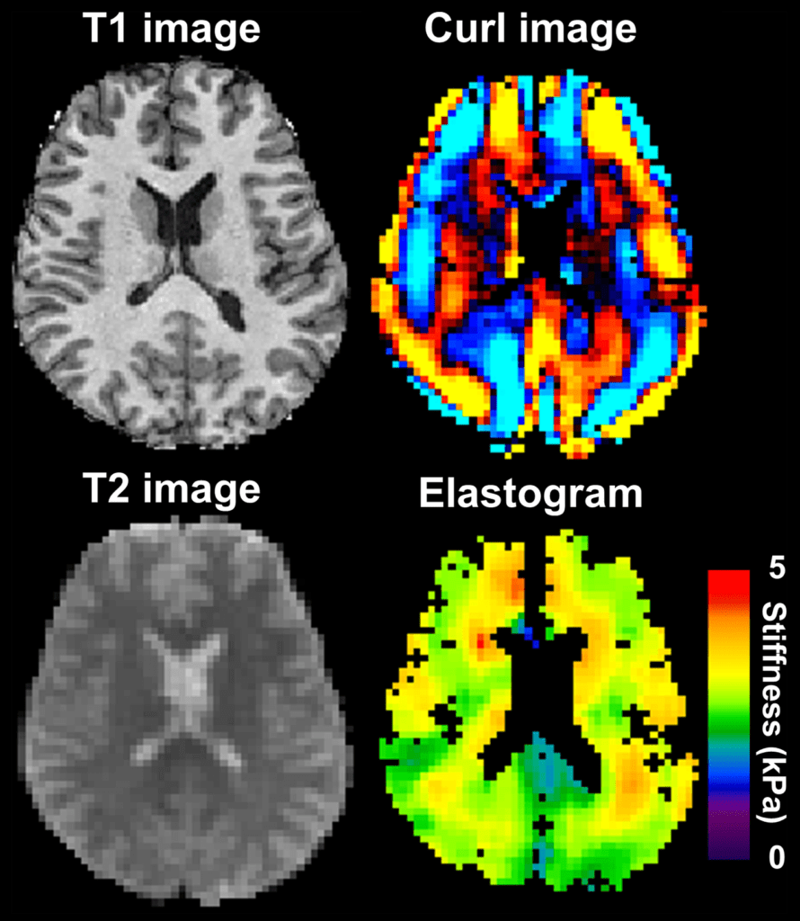 Murphy 2013 brain MRE with wave image