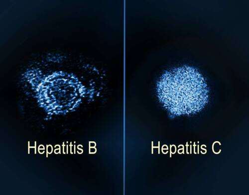 Хепатит С - 2 Нови Перспективи в Лечението 4 хепатит В, хепатит С, черен дроб