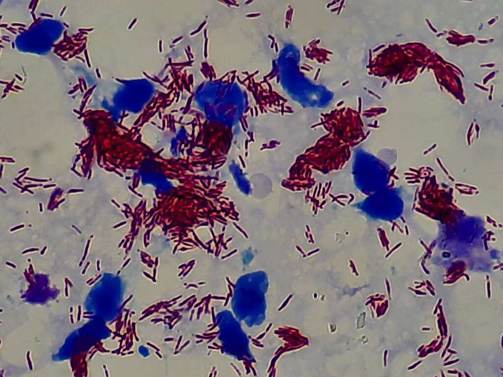 lepra_Mycobacterium_leprae_in_Magnification_of_4000X